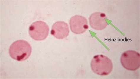 rbc morphology abnormal results|Iba pa.